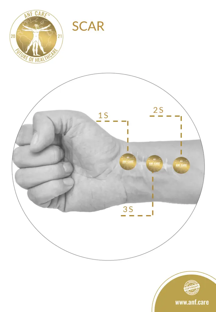20.B2C.SCAR.webp